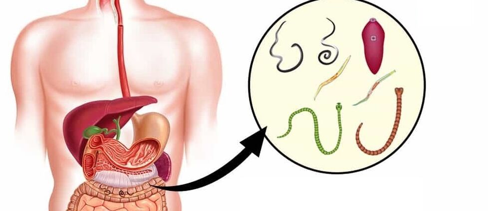 Parasieten in het menselijk lichaam