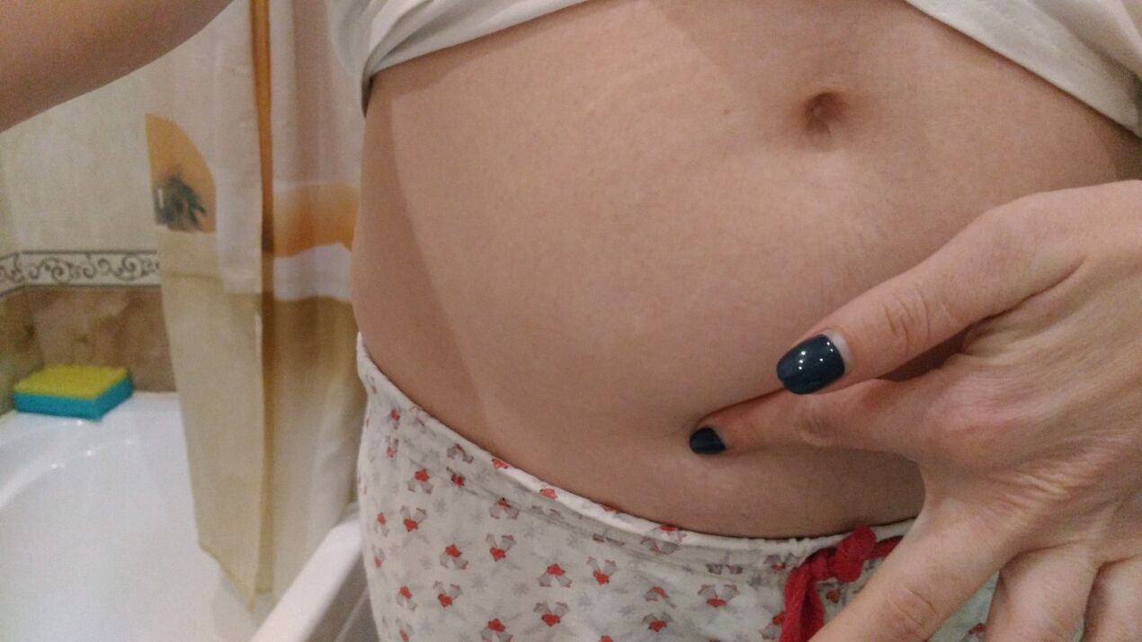 Tekenen van worminfectie uit persoonlijke ervaring