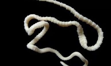 hoe de cestodeparasiet uit het lichaam te verwijderen