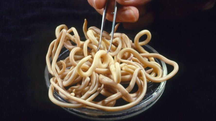 parasieten uit het menselijk lichaam