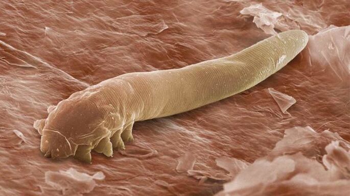 Onderhuidse parasiet onder een microscoop