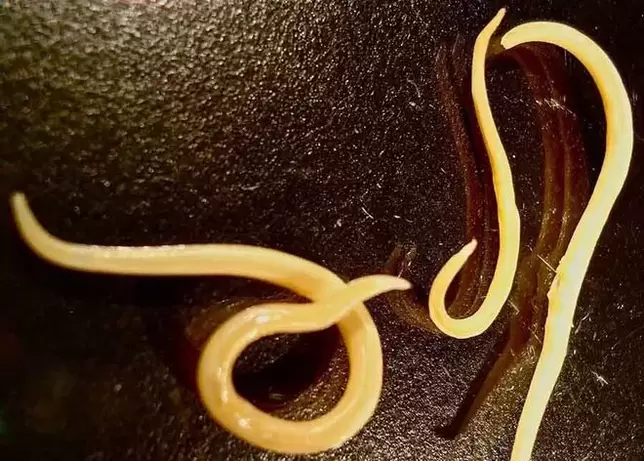 protozoaire parasiet uit het menselijk lichaam
